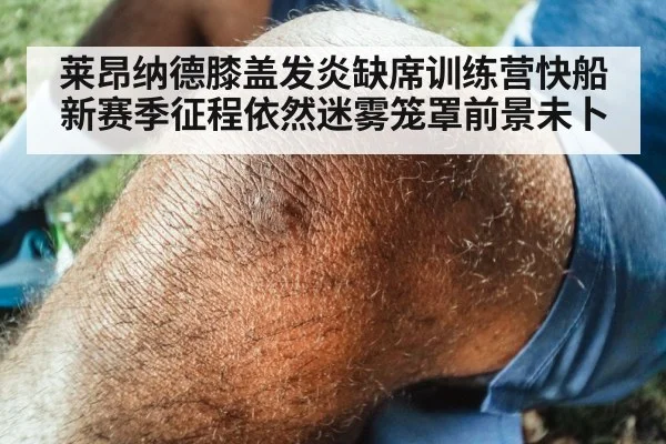 莱昂纳德膝盖发炎缺席训练营快船新赛季征程依然迷雾笼罩前景未卜